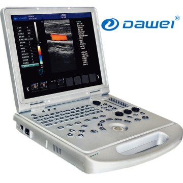 Cardiac Portable Ultrasound Machine Price & vascular sonar color doppler